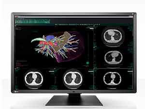 RadiForce RX660 6MP Color LCD Monitor