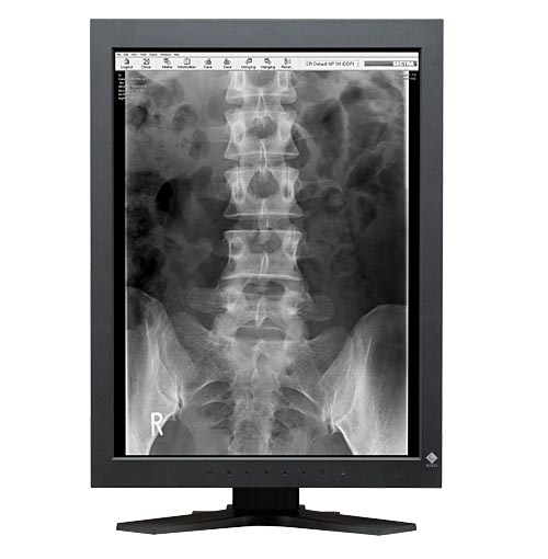 RadiForce GS220